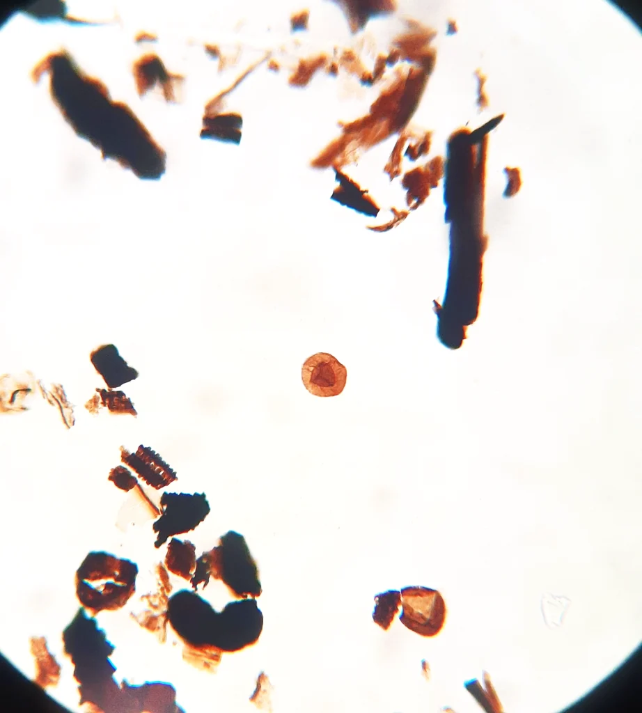 Microscopic view of Devonian vascular plant spores and fragments