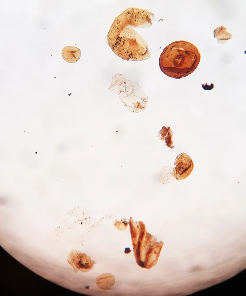 Microscopic view of Devonian vascular plant spores